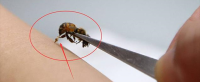 蜜蜂蜇人后為什么會死,蜜蜂刺人之后蜜蜂會死嗎
