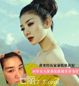 黃奕經歷家暴肌膚甚好，黃奕個人現狀