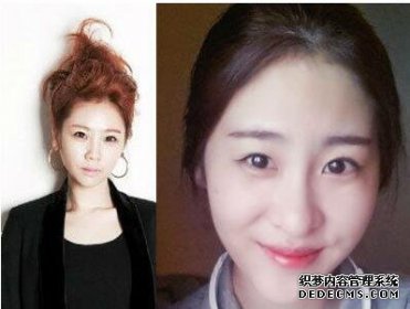 張碧晨整容前真嚇人驚悚丑照