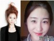張碧晨整容前真嚇人驚悚丑照