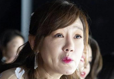 薛佳凝的臉是怎么回事,是人都不能避免自然衰老的問題