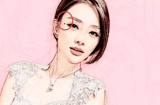 什么痣是前世留下的 身上有胎記的人 和屁股青有關(guān)嗎