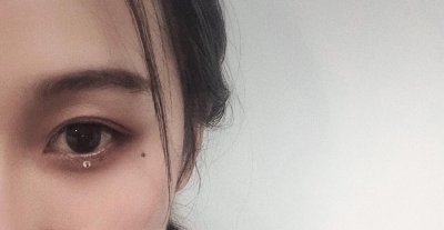 淚痣點掉好還是不點好,眼皮底下暗藏的痣不要點掉