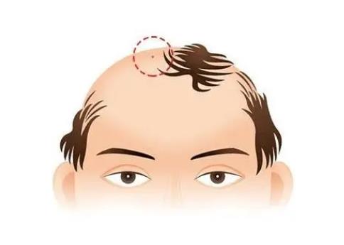 神仙下凡投胎的痣，額頭有痣的人大器晚成