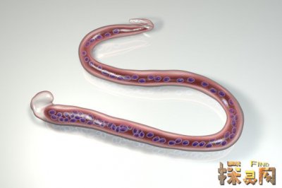世界十大惡心的寄生蟲,第六種連天后艾薇兒也沒能逃過(惡心)