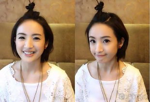 林依晨為什么不能生育