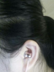 鄭宇星耳朵怎么了