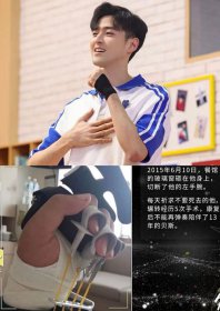 james李銖銜的手怎么了