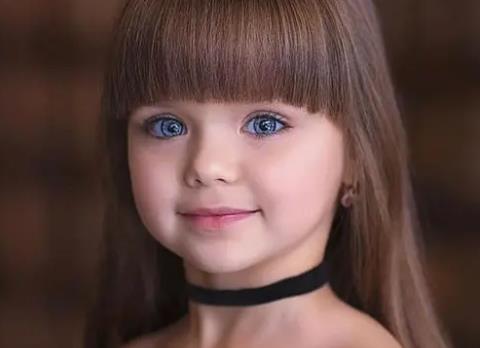 歌舞伎面譜綜合癥真的漂亮嗎,五官精致缺乏朝氣