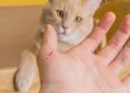 為什么好多人被貓抓不打疫苗,貓抓傷后感染狂犬病毒的概率低