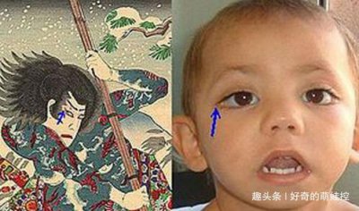 歌舞伎面譜綜合癥真的漂亮嗎,比較符合審美而已