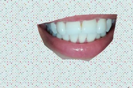 上牙代表父母下牙代表兒女,牙齒稀松表示無子女緣