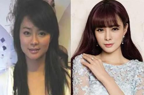 沈夢辰原來的樣子，以前土氣.現在可愛又精致