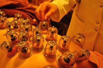 為什么年輕人不要拔罐，一般拔罐是不分男女老少的