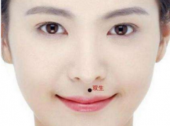 雙生痣是什么意思,一般就是指人中有痣